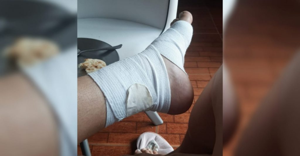 A la motociclista le ordenaron 15 días de incapacidad. Fotos suministradas